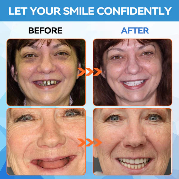 QIAWI™GelFit Functional Dentures – Made in the USA & FDA-Certified