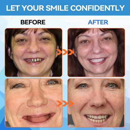 QIAWI™GelFit Functional Dentures – Made in the USA & FDA-Certified